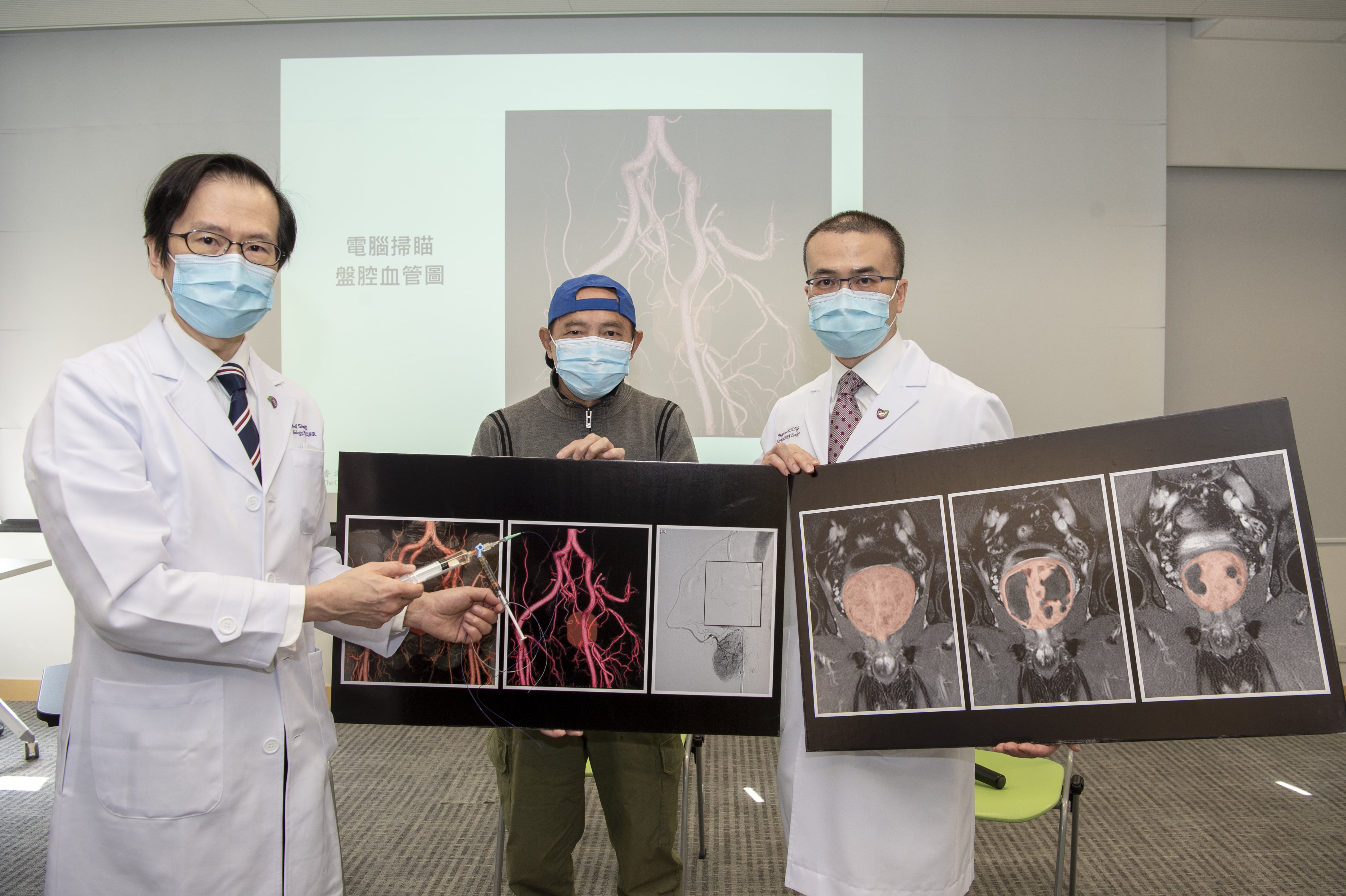 (From left) Professor Simon YU, BPH patient Mr. TAM and Professor Anthony NG
